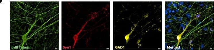 Detection of Mouse beta-III Tubulin by Immunocytochemistry/Immunofluorescence