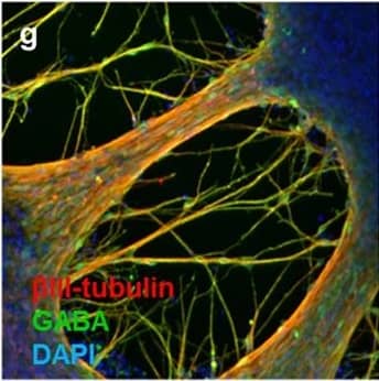 Detection of Human beta-III Tubulin by Immunocytochemistry/Immunofluorescence