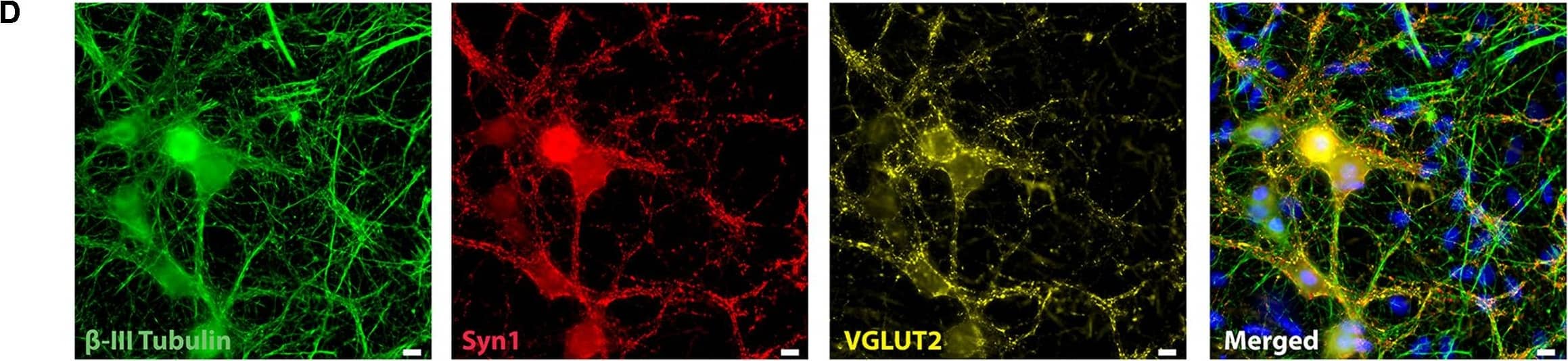 Detection of Mouse beta-III Tubulin by Immunocytochemistry/Immunofluorescence