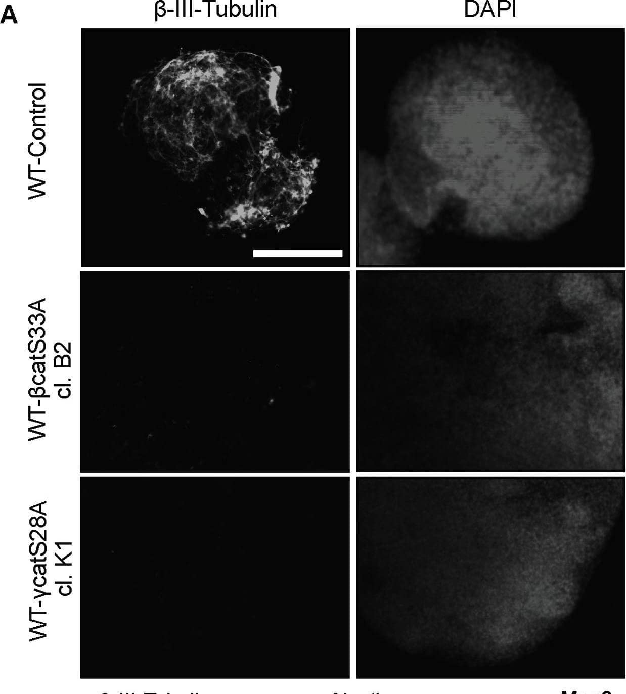 Detection of Mouse beta-III Tubulin by Immunocytochemistry/ Immunofluorescence