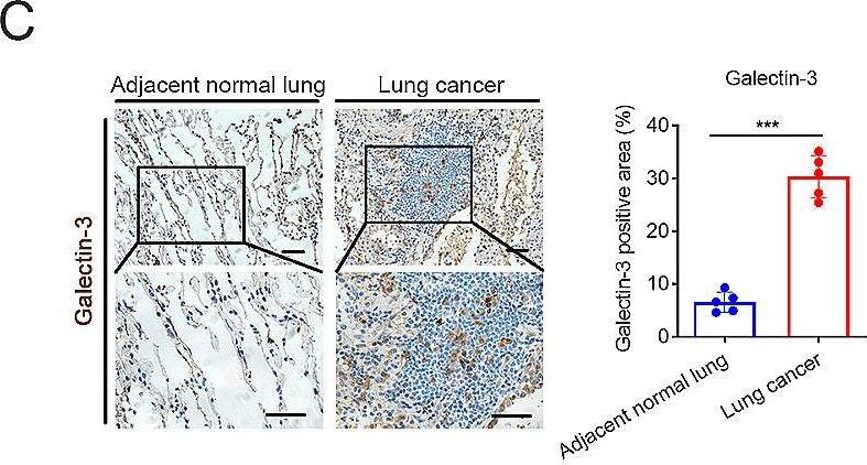 Detection of Galectin-3 by Immunohistochemistry