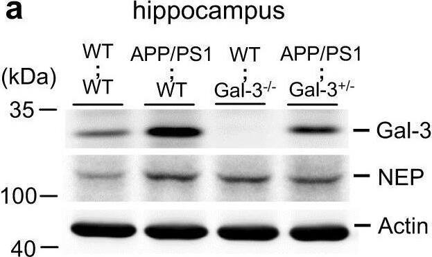Detection of Galectin-3 by Western Blot