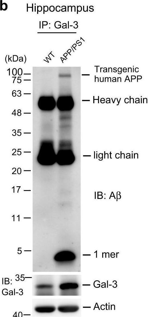 Detection of Galectin-3 by Western Blot