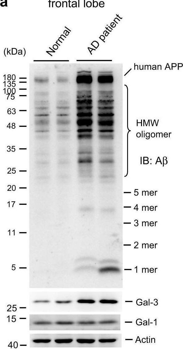 Detection of Galectin-3 by Western Blot