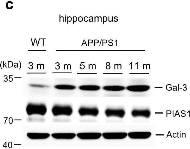 Detection of Galectin-3 by Western Blot