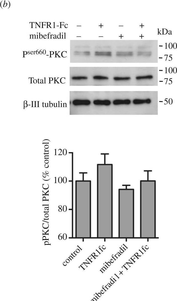 Detection of IL-18 BPa by Western Blot