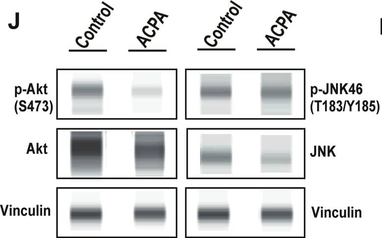 Detection of Human JNK1/2/3 by Simple Western