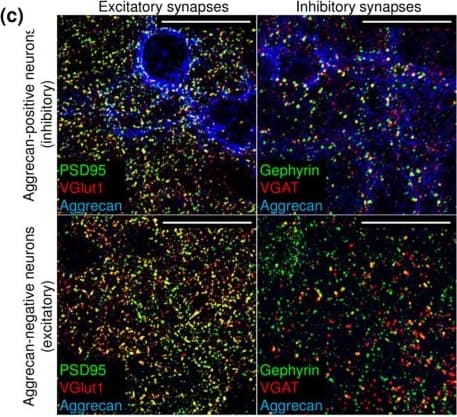 Detection of Mouse Human Aggrecan G1-IGD-G2 Domains Antibody by Immunocytochemistry/ Immunofluorescence