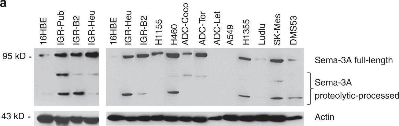 Detection of Semaphorin 3A by Western Blot