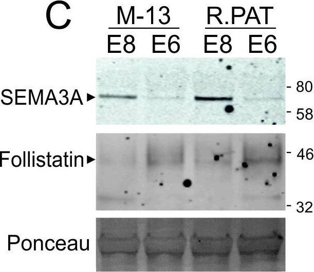 Detection of Human Semaphorin 3A by Western Blot