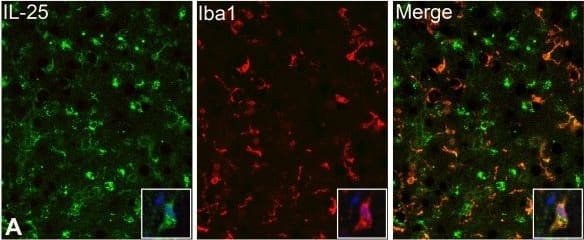 Detection of Human IL-17E/IL-25 by Immunocytochemistry/Immunofluorescence