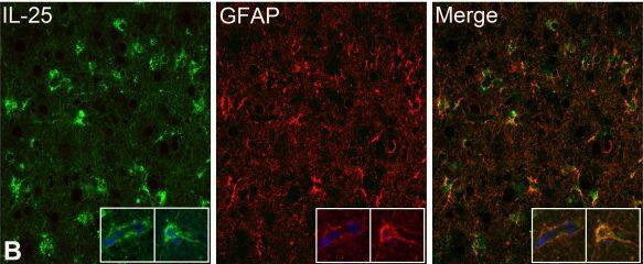 Detection of Human IL-17E/IL-25 by Immunocytochemistry/Immunofluorescence