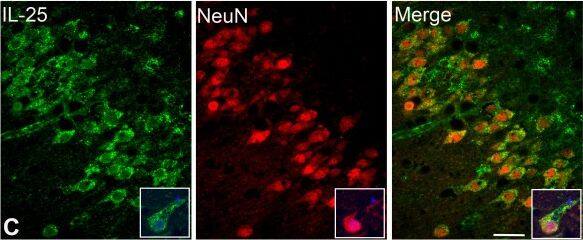 Detection of Human IL-17E/IL-25 by Immunocytochemistry/Immunofluorescence