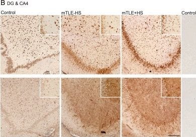 Detection of Human IL-17E/IL-25 by Immunocytochemistry/Immunofluorescence