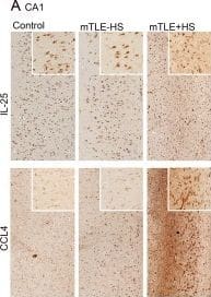 Detection of Human IL-17E/IL-25 by Immunocytochemistry/Immunofluorescence