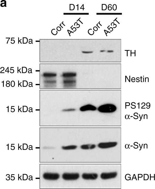 Detection of Mouse Human Nestin Antibody by Western Blot