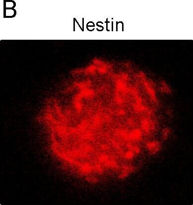 Detection of Rat Nestin by Immunocytochemistry/Immunofluorescence
