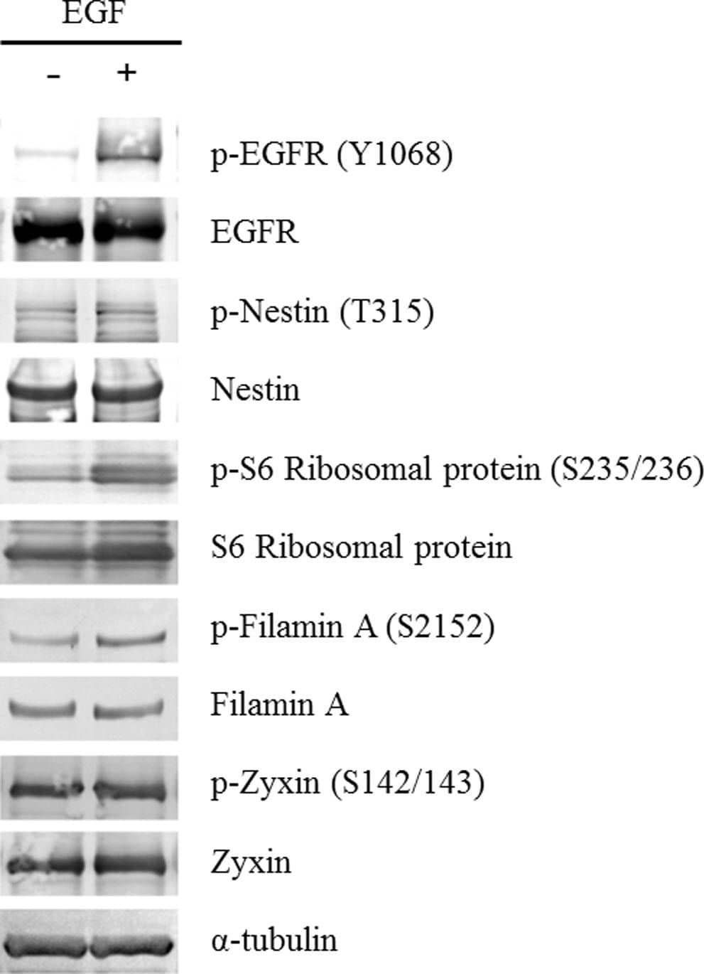 Detection of Human Nestin by Western Blot