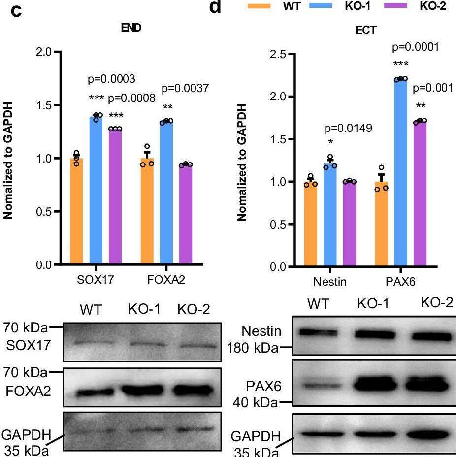 Detection of Nestin by Western Blot