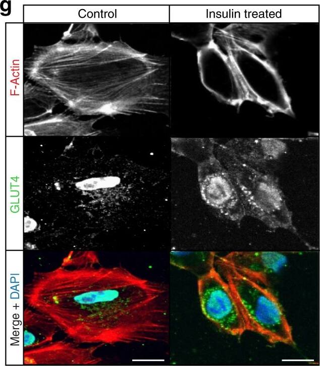 Detection of Human Glut4 by Immunocytochemistry/Immunofluorescence