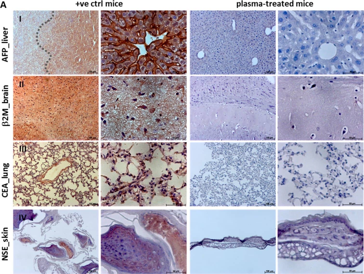 Detection of Mouse alpha-Fetoprotein/AFP by Immunohistochemistry