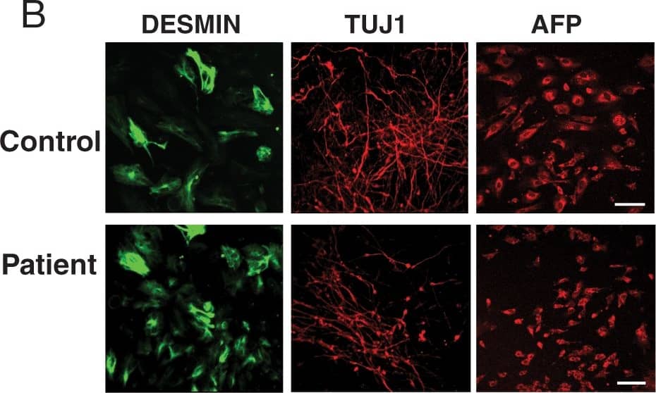 Detection of Human alpha-Fetoprotein/AFP by Immunocytochemistry/Immunofluorescence