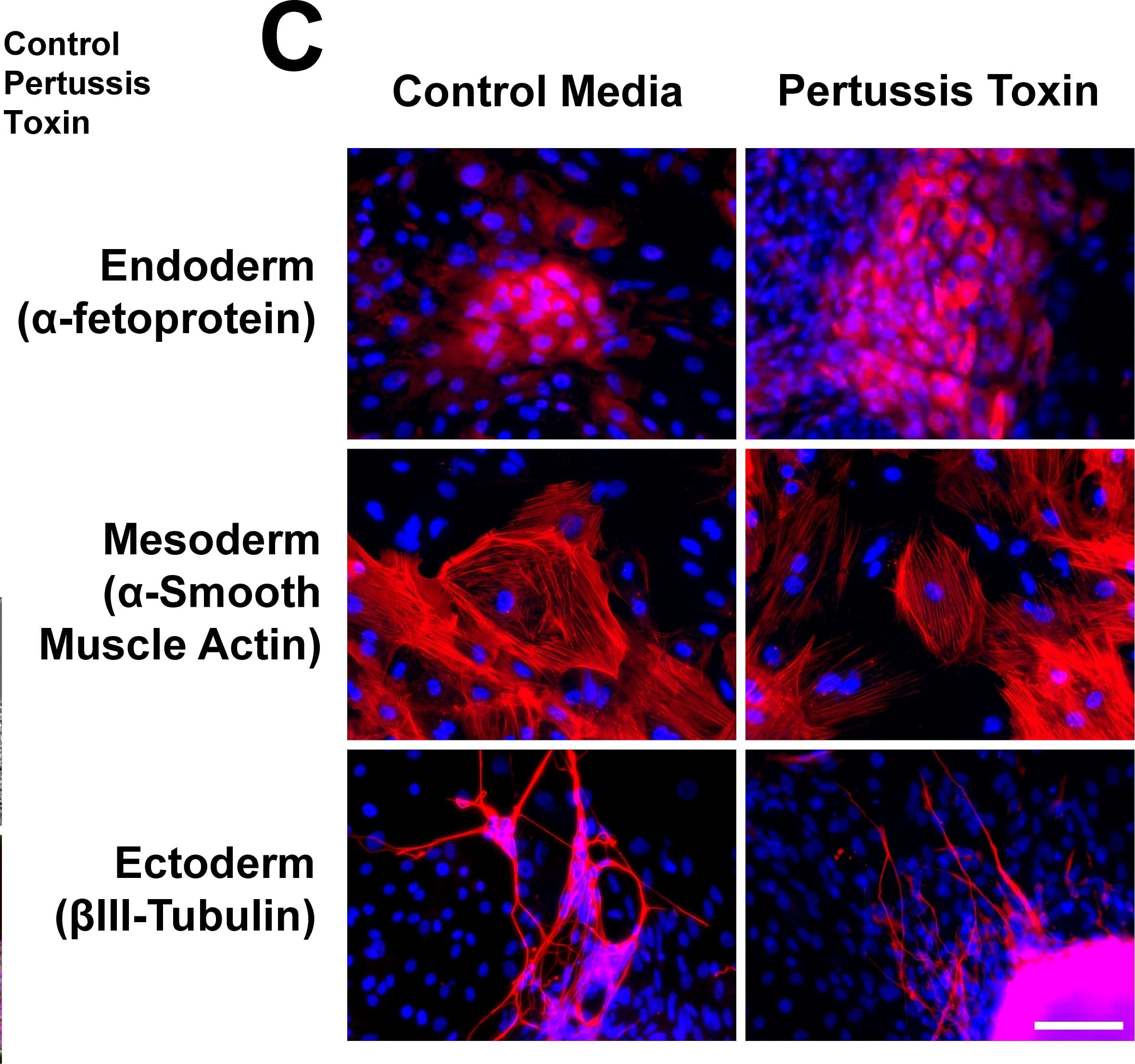 Detection of Human alpha-Fetoprotein/AFP by Immunocytochemistry/Immunofluorescence