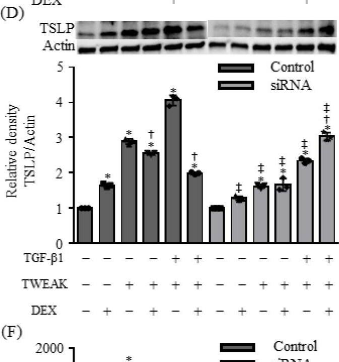 Detection of TSLP by Western Blot