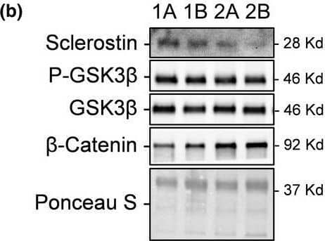 Detection of SOST/Sclerostin by Western Blot