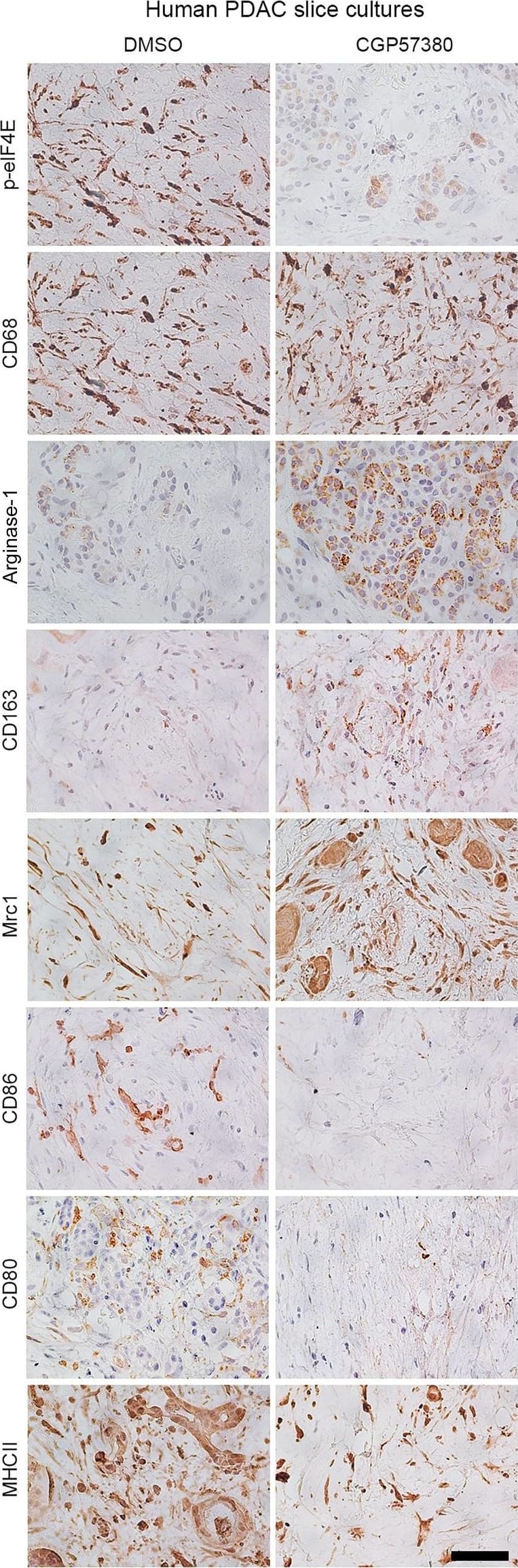 Detection of Mouse B7-1/CD80 by Immunohistochemistry