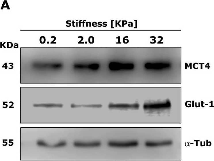 Detection of Glut1 by Western Blot
