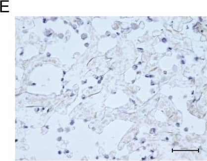 Detection of Human Osteocalcin by Immunocytochemistry/Immunofluorescence