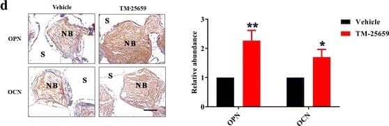 Detection of Human Osteocalcin by Immunohistochemistry