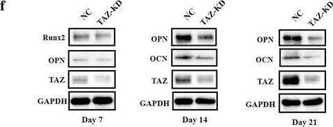 Detection of Human Osteocalcin by Western Blot