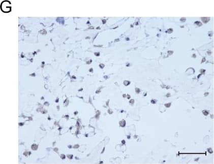 Detection of Human Osteocalcin by Immunocytochemistry/Immunofluorescence