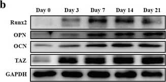 Detection of Human Osteocalcin by Western Blot
