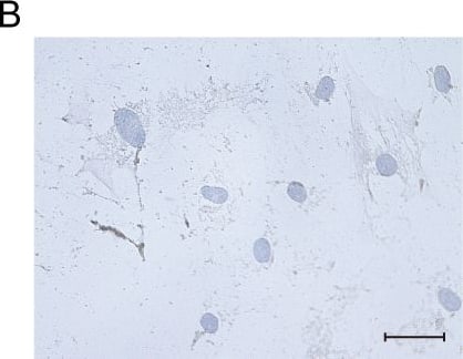 Detection of Human Osteocalcin by Immunocytochemistry/Immunofluorescence