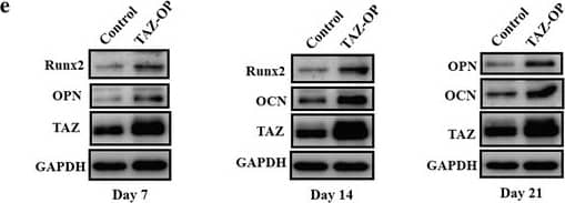 Detection of Human Osteocalcin by Western Blot