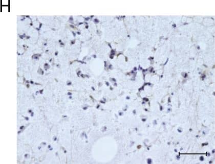 Detection of Human Osteocalcin by Immunocytochemistry/Immunofluorescence