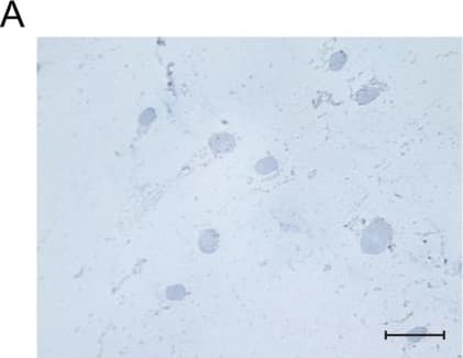 Detection of Human Osteocalcin by Immunocytochemistry/Immunofluorescence