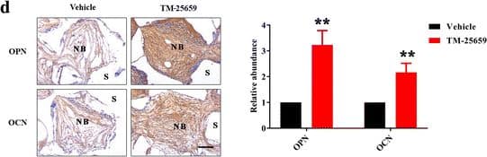 Detection of Human Osteocalcin by Immunohistochemistry