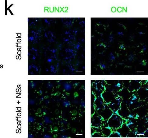 Detection of Human Osteocalcin by Immunohistochemistry