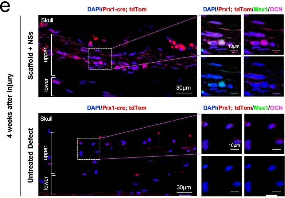 Detection of Human Osteocalcin by Immunohistochemistry