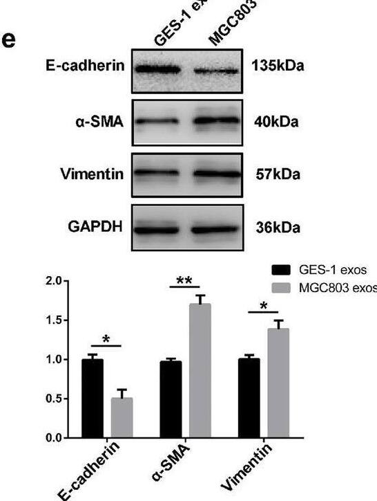 Detection of alpha -Smooth Muscle Actin by Western Blot