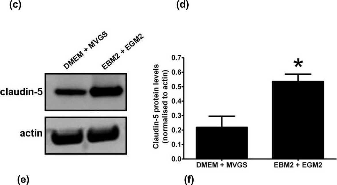Detection of Rat alpha -Smooth Muscle Actin by Western Blot