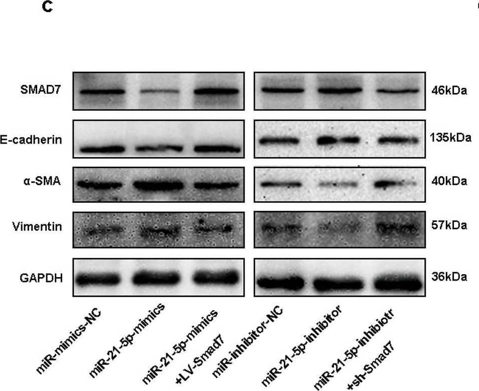 Detection of alpha -Smooth Muscle Actin by Western Blot