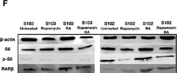 Detection of Human alpha -Smooth Muscle Actin by Western Blot