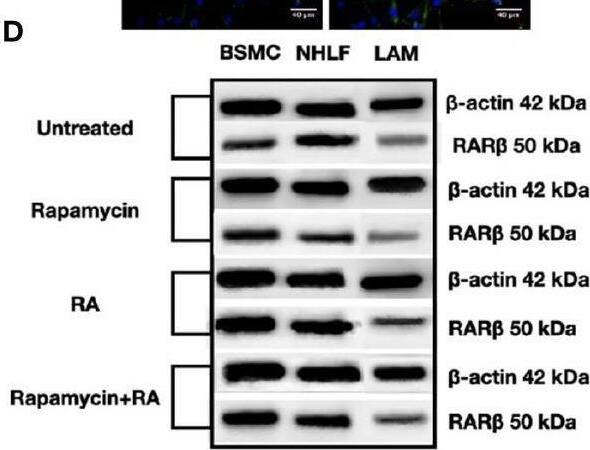 Detection of Human alpha -Smooth Muscle Actin by Western Blot
