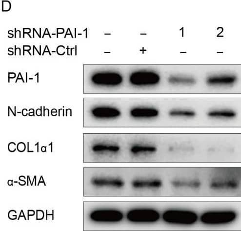Detection of Mouse alpha -Smooth Muscle Actin by Western Blot