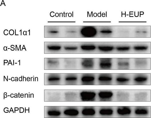 Detection of Mouse alpha -Smooth Muscle Actin by Western Blot